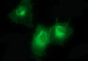 PDGFRB / PDGFR Beta Antibody (clone OTI1E8, Carrier-free)