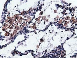 VWA5A Antibody (clone OTI3D6)