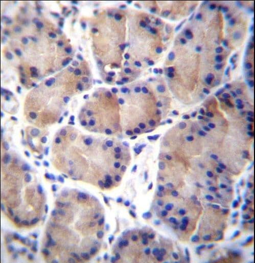 Polyclonal Rabbit anti-Human CES4A Antibody (aa533-561, IHC, WB)