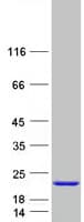 Human RABIF Protein (Recombinant Myc-DDK (Flag))