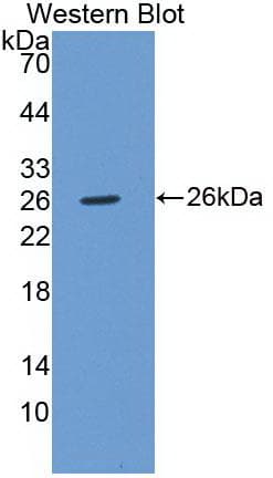 DRPLA / Atrophin-1 Antibody