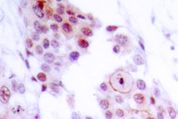 Polyclonal Rabbit anti-Human MEF2A / MEF2 Antibody (Pro313, IHC)