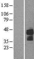 Human TNFRSF10B / Killer / DR5 Protein (Over-Expression Lysate Myc-DDK (Flag))