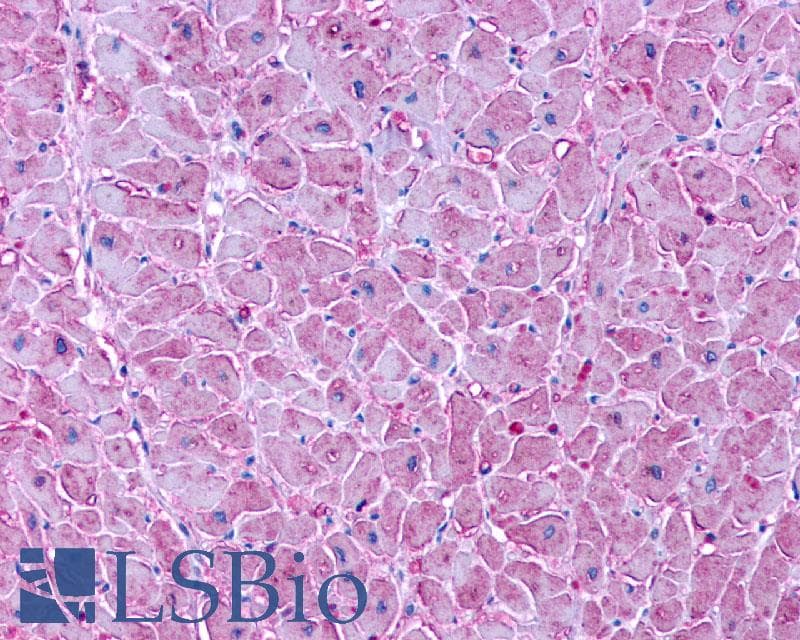 PathPlus™ Polyclonal Rabbit anti-Human LPAR3 / LPA3 / EDG7 Antibody (Cytoplasmic Domain, IHC)