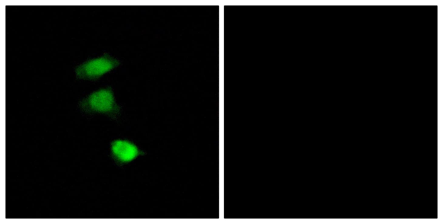 IRS1 Antibody (phospho-Ser307)
