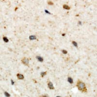 Polyclonal Rabbit anti-Human CSGALNACT2 Antibody (Internal, IHC, WB)