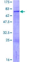 Human LHX9 Protein (Recombinant GST)