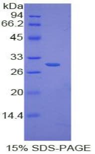 Human NFKBID / IkappaBNS Protein (Recombinant His-T7)