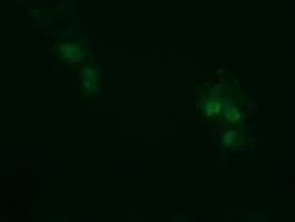 IHC-plus™ TCL / RHOJ Antibody (clone 1D7)