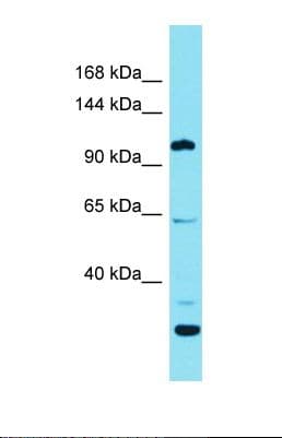 Polyclonal Rabbit anti-Human ESPNL Antibody (C-Terminus, WB)