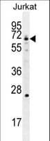 GCLC Antibody (aa1-30)