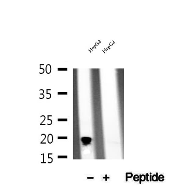 NDUFB11 Antibody