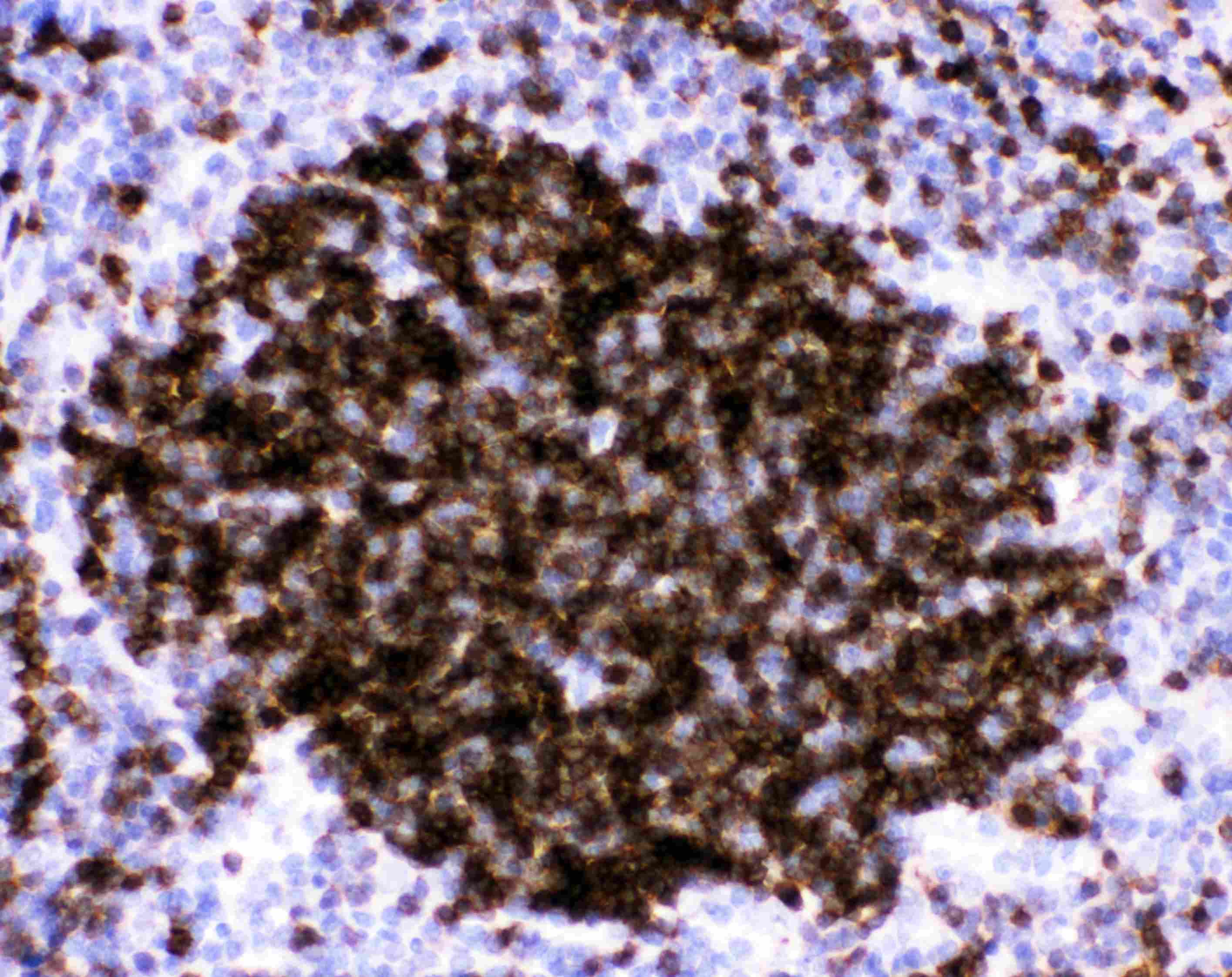 FCER2 / CD23 Antibody (aa50-331)
