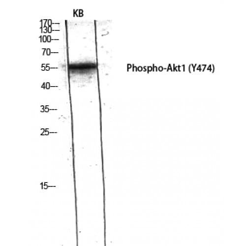 AKT1 Antibody (410-490 aa)