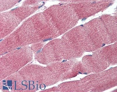 IHC-plus™ Monoclonal Mouse anti-Human LDHA / LDH1 Antibody (IHC, WB)