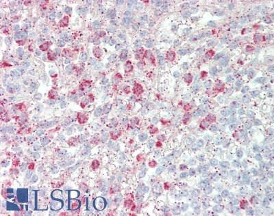 IHC-plus™ IL-22BP / IL22RA2 Antibody