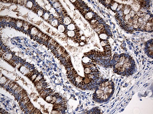 Monoclonal Mouse anti-Human CYP7B1 Antibody (clone OTI1G7, aa263-506, IHC, WB)