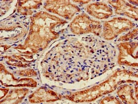 SLC5A1 / SGLT1 Antibody