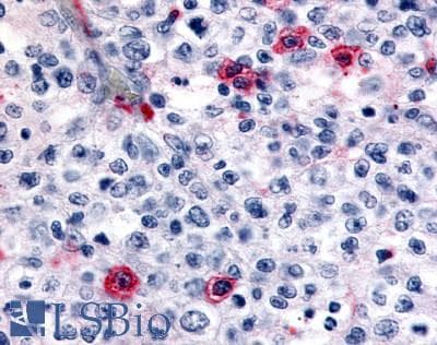 PathPlus™ HRH4 / Histamine H4 Receptor Antibody (Cytoplasmic Domain)