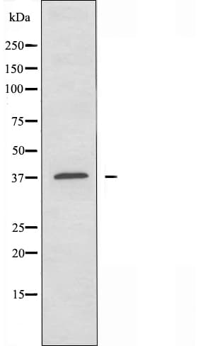 CA-VB / CA5B Antibody