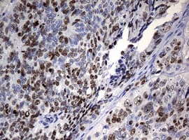 Monoclonal Mouse anti-Human MKI67 / Ki67 Antibody (clone OTI5D7, IHC)