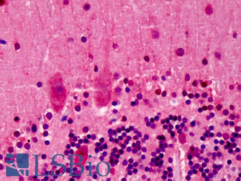 IHC-plus™ LGI2 Antibody
