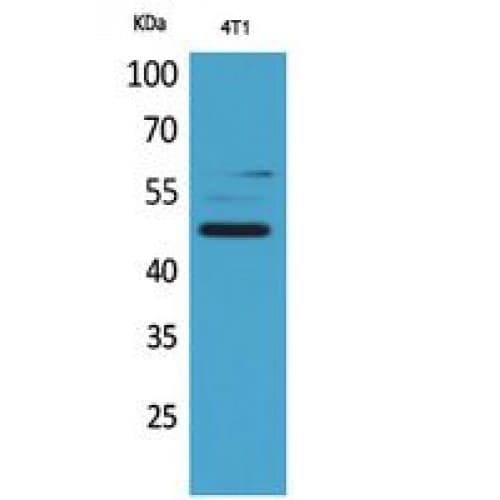 Alpha-1-Antichymotrypsin Antibody (251-300 aa, Internal)