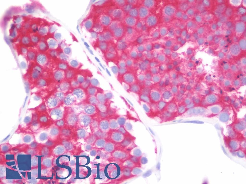 IHC-plus™ CLDN16 / Claudin 16 Antibody (aa6-33)