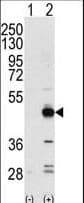 TRB3 / TRIB3 Antibody (aa15-45)