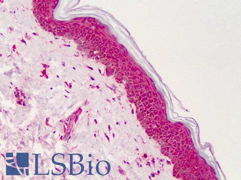 IHC-plus™ PPARG / PPAR Gamma Antibody