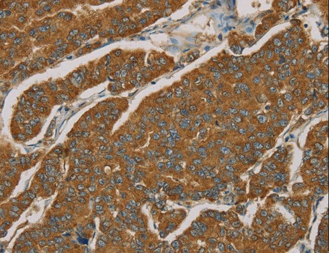 NPPB / BNP Antibody