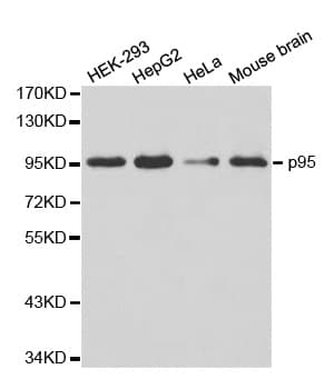 IHC-plus™ NBN / Nibrin Antibody