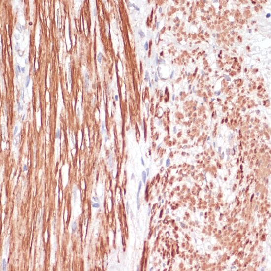DES / Desmin Antibody