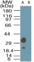 STRADA / LYK5 Antibody (aa300-350)