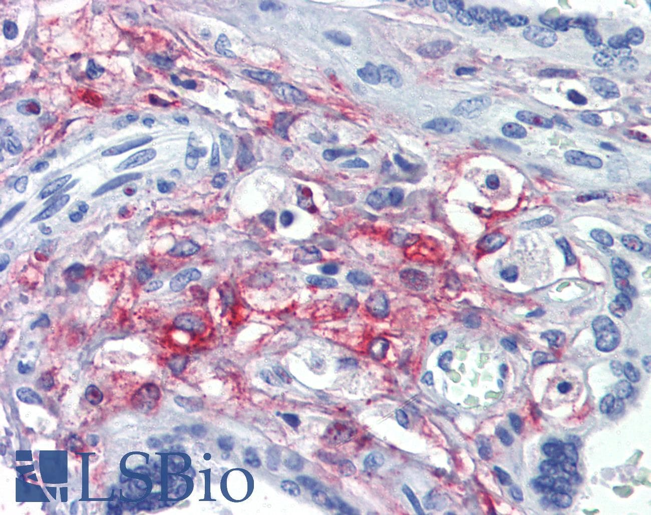 IHC-plus™ Polyclonal Goat anti-Human SLC46A1 / HCP1 Antibody (aa57-70, IHC)