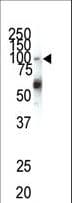 EPHA1 / EPH Receptor A1 Antibody (aa29-60)