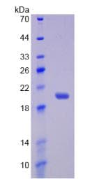 Human IL17RB Protein (Recombinant His, N-Terminal)