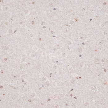 KDM3A / JMJD1A Antibody