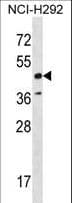 RAD52 Antibody (aa387-416)