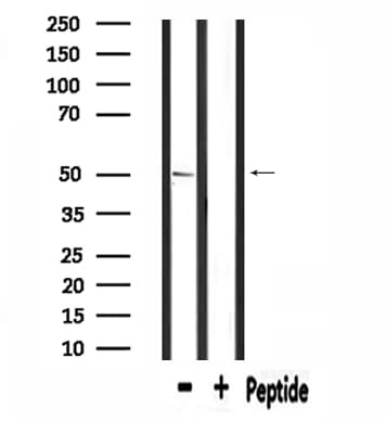 Polyclonal Rabbit anti-Human SLC39A7 / ZIP7 Antibody (IF, WB)
