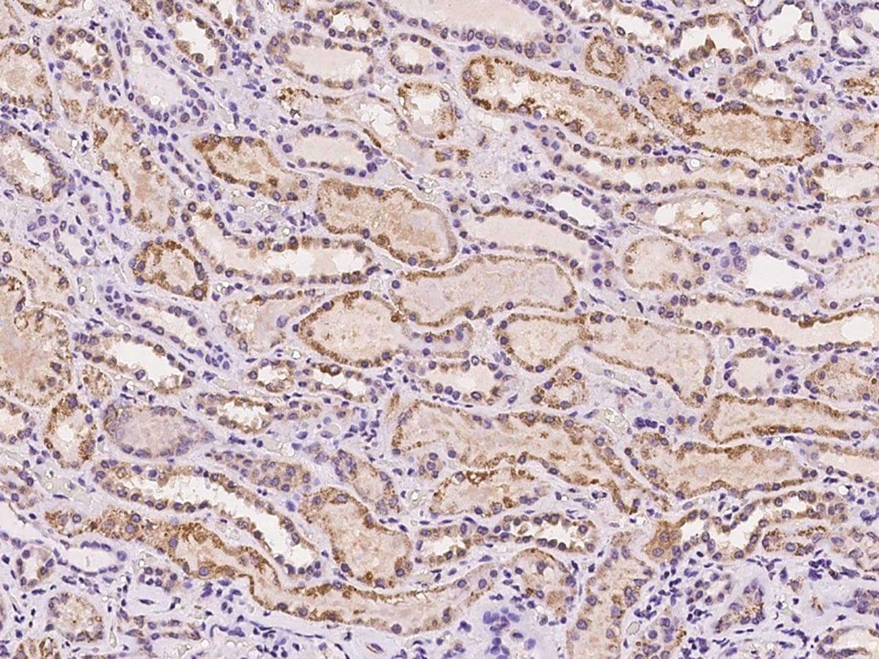 Polyclonal Rabbit anti-Human AMD / AMD1 Antibody (IHC)