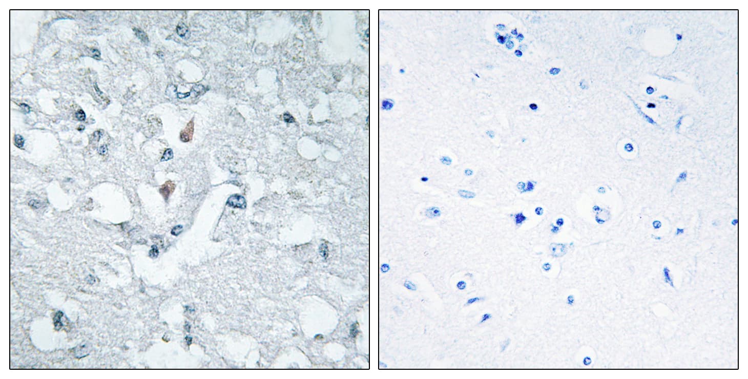 Polyclonal Rabbit anti-Human GLYCTK / Glycerate Kinase Antibody (aa101-150, IHC, IF, WB)