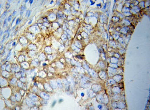 Polyclonal Rabbit anti-Human HSPA5 / GRP78 / BiP Antibody (IHC, WB)
