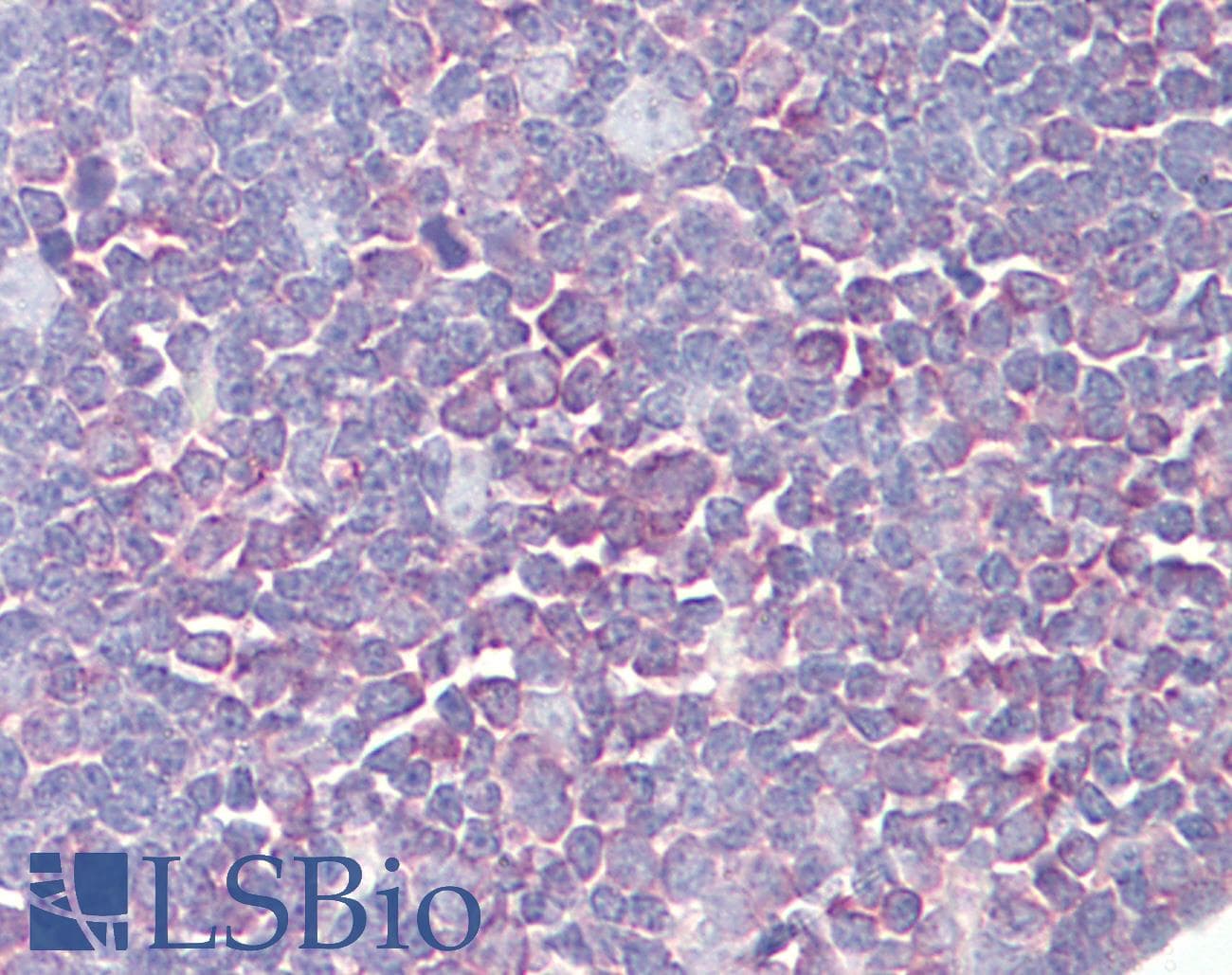 PTK2B / PYK2 Antibody (aa812-861)