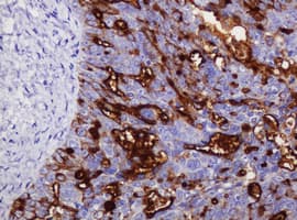 EMA / MUC1 Antibody (clone OTI3A7)