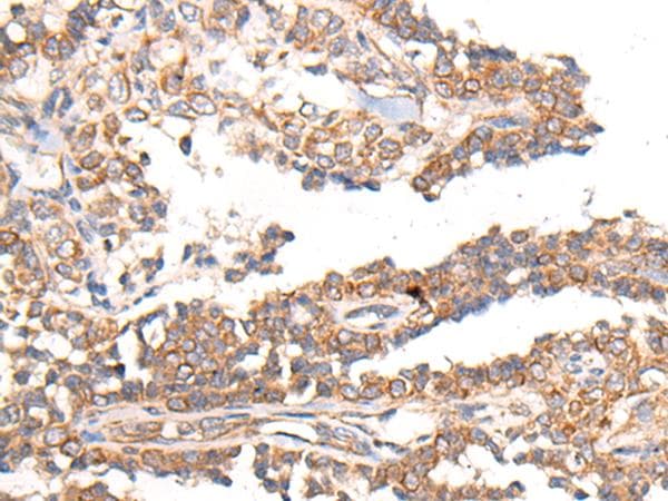 Polyclonal Rabbit anti-Human MTNR1B / MT2 Antibody (IHC)