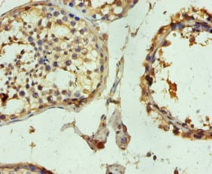TUBB3 / Tubulin Beta 3 Antibody