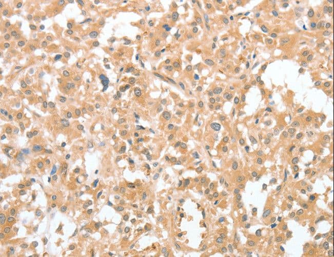 CIAPIN1 / Anamorsin Antibody
