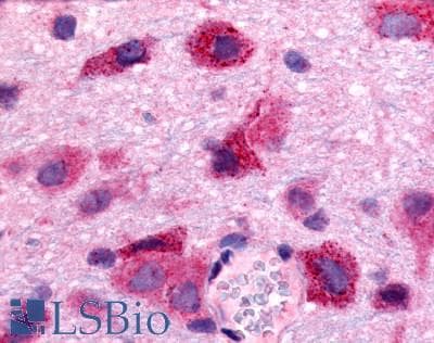 IHC-plus™ Polyclonal Rabbit anti-Human S1PR5 / EDG8 / S1P5 Antibody (N-Terminus, IHC)