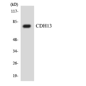 Polyclonal Rabbit anti-Human CDH13 / Cadherin 13 Antibody (aa303-352, IHC, WB)